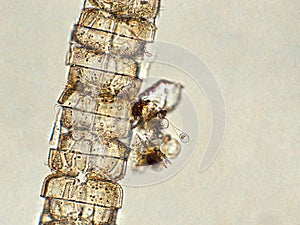 Algae with zooplankton under microscopic view