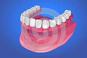 All missing teeth - removable full denture. illustration