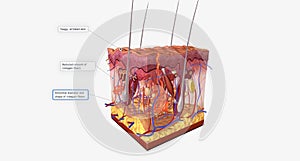 All types of EDS are caused by inherited, genetic abnormalities that affect the different genes responsible for collagen formation