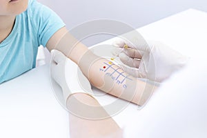 Allergen test on hand. child undergoing procedure of allergen skin test