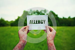 Allergic woman hands holding a paper sheet with allergy text over a green field natural background. Different symptoms of eczema,