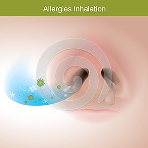 Allergies inhalation. Illustration show close up human nose. photo