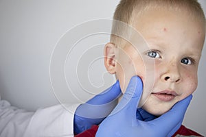 An allergist or dermatologist examines red spots on a childÃ¢â¬â¢s face. The boy suffers from a rash, hives and itching. Food Allergy photo