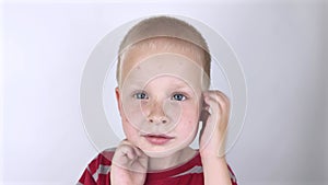 An allergist or dermatologist examines red spots on a childâ€™s face. The boy suffers from a rash, hives and itching. Food Allergy