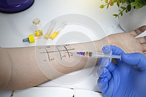 An allergist doctor in the laboratory conducts a prik allergy test. Skin test for household, food, epidermal allergic reactions photo