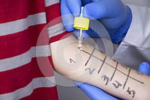 An allergist doctor makes a skin test for allergies. The boy is being examined in the laboratory, waiting for a reaction to photo