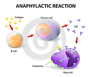 Allergy and anaphylaxis