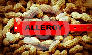 Peanut Allergy photo