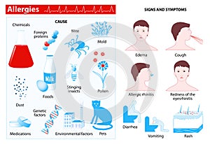 Allergy. infographic