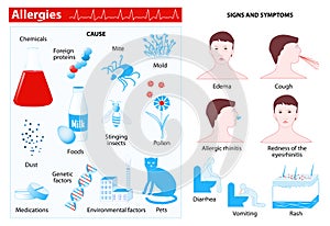 Allergy. infographic photo