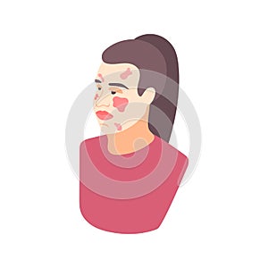 Allergy Symptoms Icon