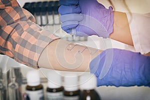 Allergy tests in laboratory