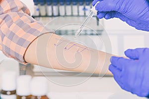 Allergy tests in laboratory