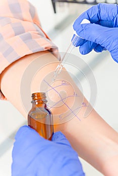 Allergy tests in laboratory