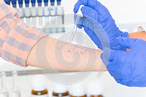 Allergy tests in laboratory