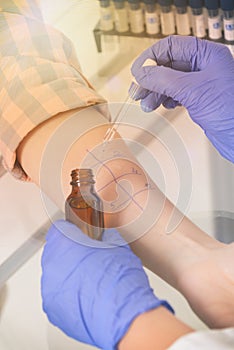 Allergy tests in laboratory