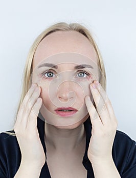 Allergy to cosmetics. The girl looks at the pimples around her eyes that appeared after using toxic cosmetics. Red spots on woman