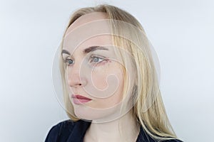 Allergy to cosmetics. The girl looks at the pimples around her eyes that appeared after using toxic cosmetics. Red spots on woman