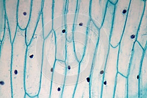 Allium bulb epidermis cells photo