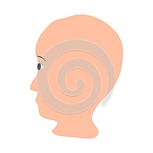 Alopecia hair. Baldness of hair on the head. Anagen Alopecia. Infographics. Vector illustration on isolated background.
