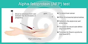 Alpha-fetoprotein AFP test. photo