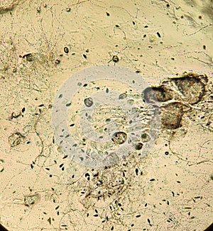 Alternaria fungal mycelium under the microscope