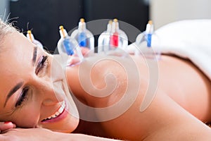 Alternative practitioner cupping woman