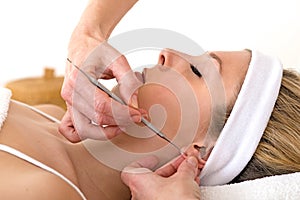 Alternative practitioner using auriculotherapy techniques.