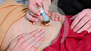 Alternative therapist applying moxibustion a traditional chinese medicine method.
