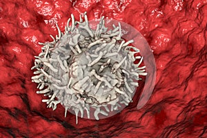 Alveolar macrophage, or dust cell