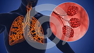 Alveoli and the bronchial tree in the human respiratory system