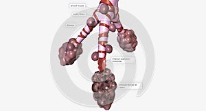 Alveoli and Bronchiole Damage from Smoking