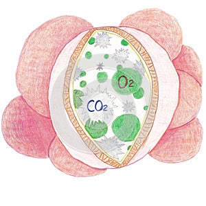 Alveoli group showing interstitial lung disease and idiopathic pulmonary fibrosis in alveoli.