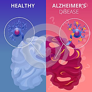 Alzheimer brain banner set, cartoon style
