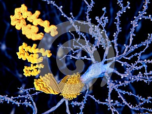 Alzheimer disease, the beta-amyloid peptid photo