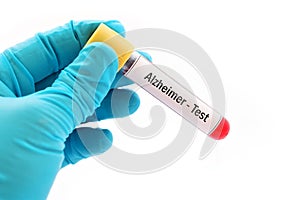 Alzheimer disease test