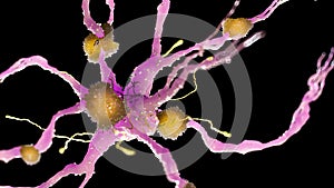 A alzheimer nerve cell