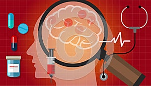 Alzheimer parkinson brain cancer medication anatomy medical health care cure disease