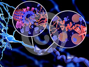 Tau protein phosphorylation leads to disintegration of microtubuli and aggregation to neurofibrillary tangles. photo