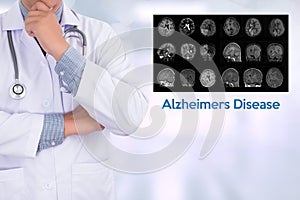 Alzheimers Disease concept , Brain degenerative diseases Parkin