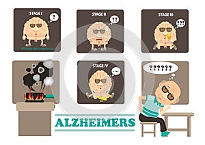 Alzheimers photo