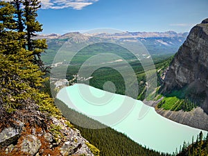 Amazing Lake Louise View, Banff NP