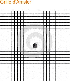 (Amd Screening. Macular Degeneration Test. Vision control. Grid scotoma eye test. Printable chart retina examination. With Grille