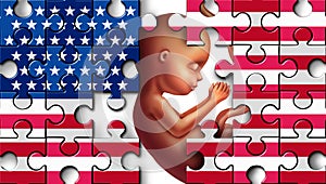 American Abortion Issues