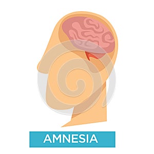 Amnesia symptom Alzheimer disease brain damage isolated head
