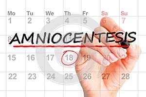 Amniocentesis schedule date on calendar