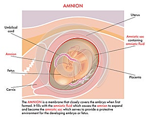 Amnion medical illustration