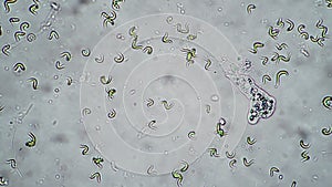 Amoeba moving in the water between the algae close-up time lapse