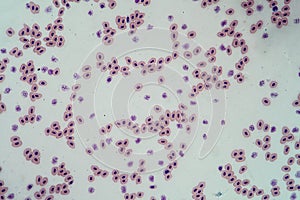 Amphibian blood cells with cell nuclei