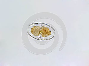 Amphora sp. algae under microscopic view photo